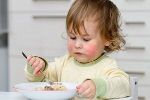 آلرزی غذایی در کودکان کیدز 24